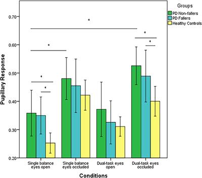 Pupillary Response to Postural Demand in Parkinson’s Disease